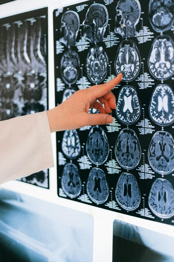 Doctor reviewing brain MRI scan